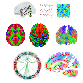 humanbrain