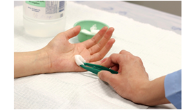 Wound_dressing