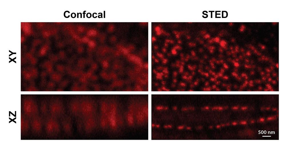 Sted Raptis ULS Equipment Upgrade - Abberior STED Super-resolution Microcsope | ULS