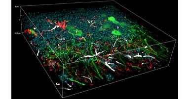 Super-resolved Fluorescence Microscopy